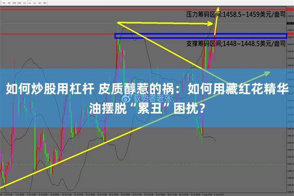 如何炒股用杠杆 皮质醇惹的祸：如何用藏红花精华油摆脱“累丑”困扰？